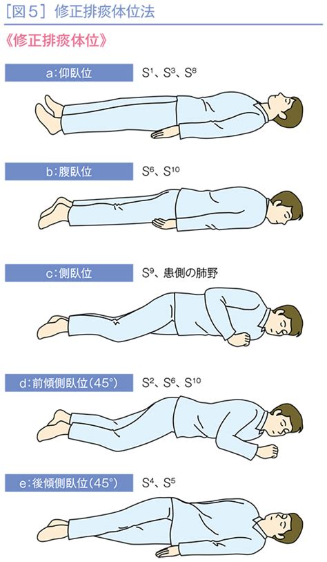 左前傾側臥位|【側臥位の向きをどう決める？】両側の肺が悪いとき。